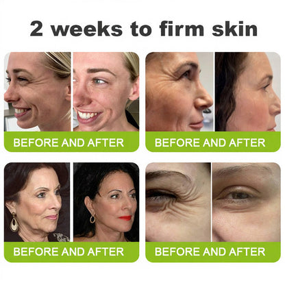👨‍⚕️Made and shipped from the USA 💫LOVILDS® Skin Tightening & Vita-A Retinol Retinol shot Anti-Wrinkle Firming Tightening cream - Last Day Promotion 70% OFF