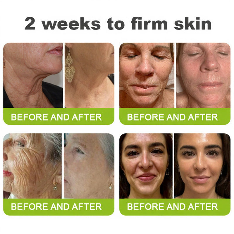 👨‍⚕️Made and shipped from the USA 💫LOVILDS® Skin Tightening & Vita-A Retinol Retinol shot Anti-Wrinkle Firming Tightening cream - Last Day Promotion 70% OFF