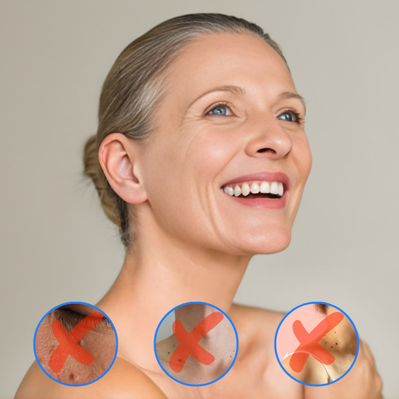 LUMIVO™ CryoCure Spray | At-home cryotherapy for common warts
