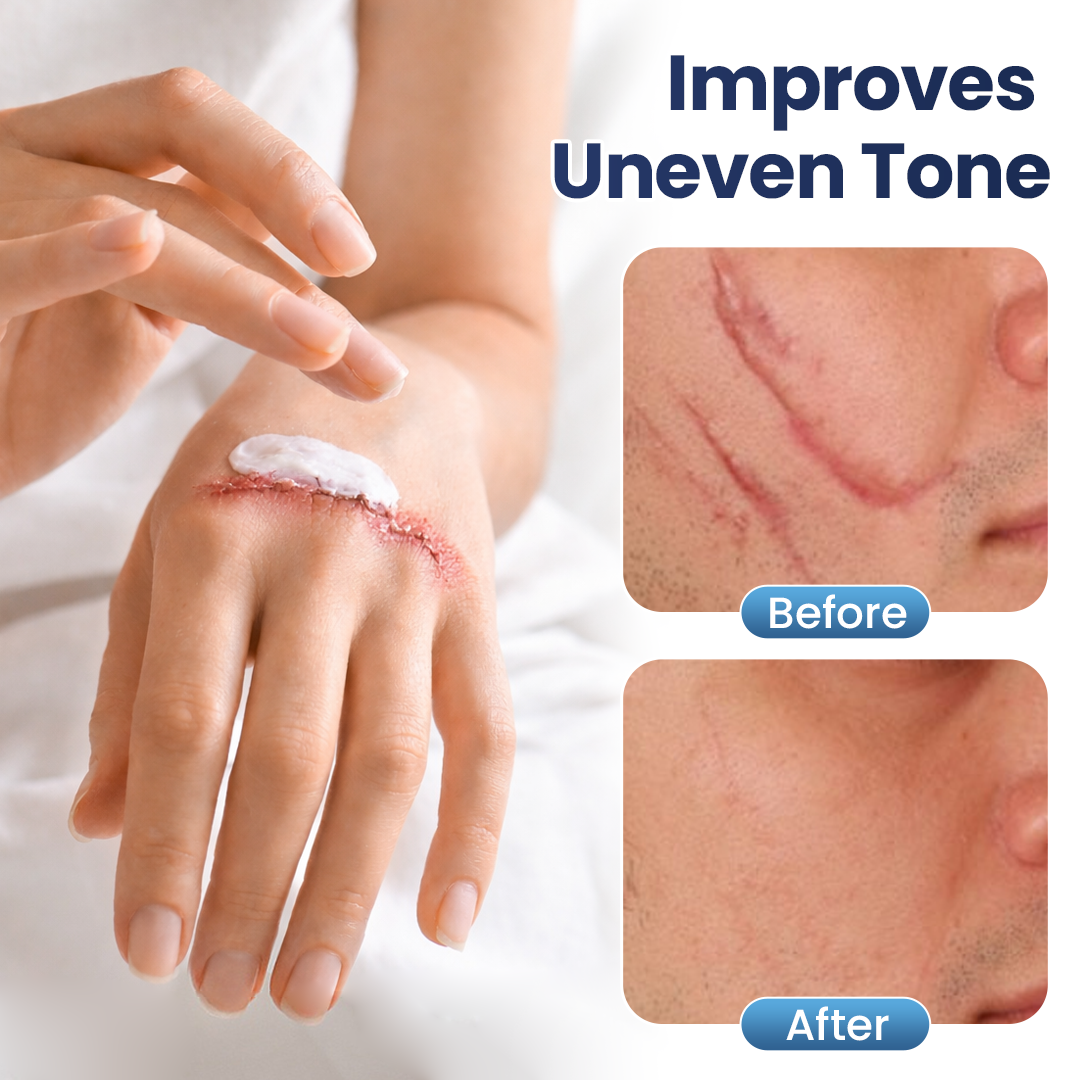𝑶𝒇𝒇𝒊𝒄𝒊𝒂𝒍 𝑺𝒕𝒐𝒓𝒆 | Juxek® Texture Repair Gel — Say Goodbye to Stubborn Scars & Uneven Texture in 4 Weeks