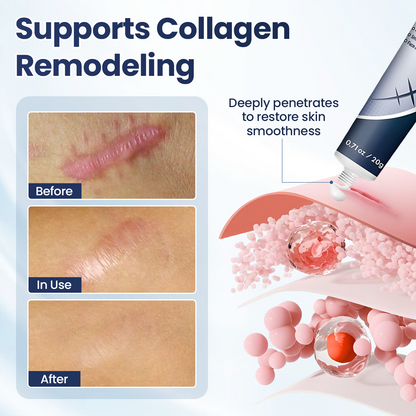 𝑶𝒇𝒇𝒊𝒄𝒊𝒂𝒍 𝑺𝒕𝒐𝒓𝒆 | Juxek® Texture Repair Gel — Say Goodbye to Stubborn Scars & Uneven Texture in 4 Weeks