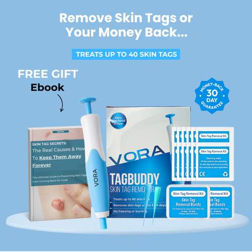 LUMIVO™ – No More Skin Tags. Safe, Gentle & Effective Results ✨