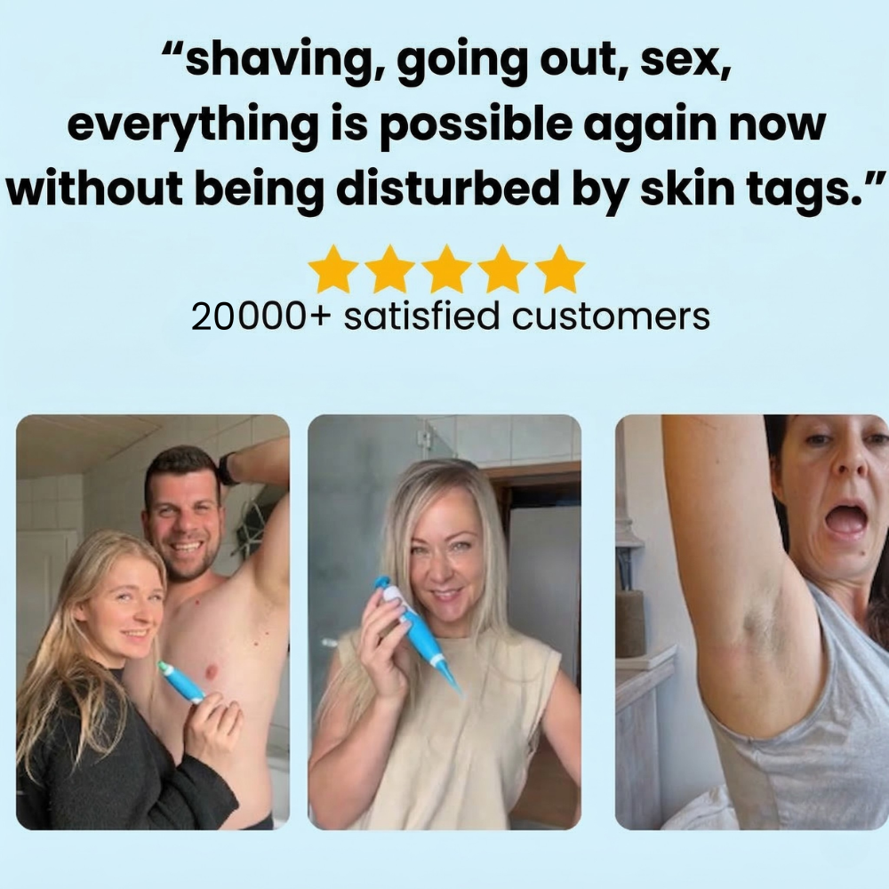 LUMIVO™ – No More Skin Tags. Safe, Gentle & Effective Results ✨