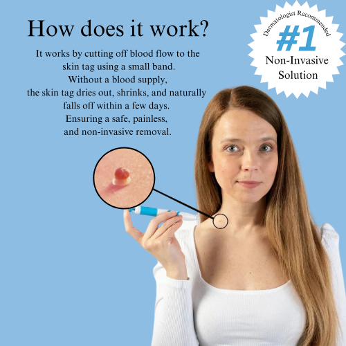LUMIVO™ – No More Skin Tags. Safe, Gentle & Effective Results ✨