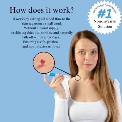 LUMIVO™ – No More Skin Tags. Safe, Gentle & Effective Results ✨